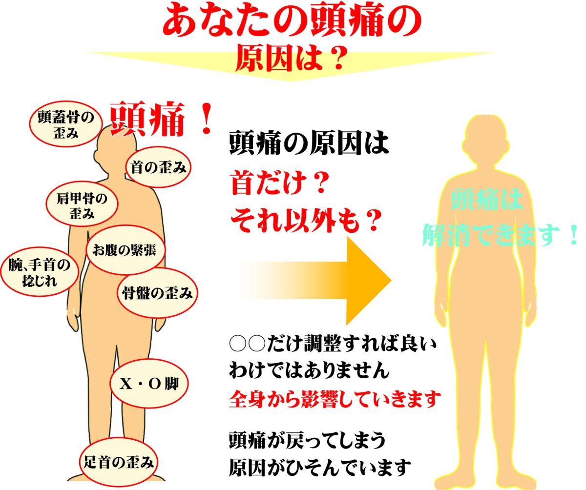 頭痛の原因